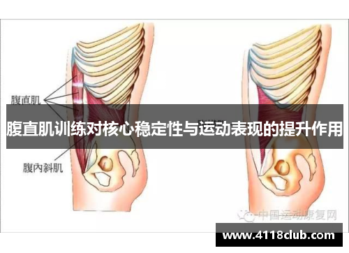 腹直肌训练对核心稳定性与运动表现的提升作用